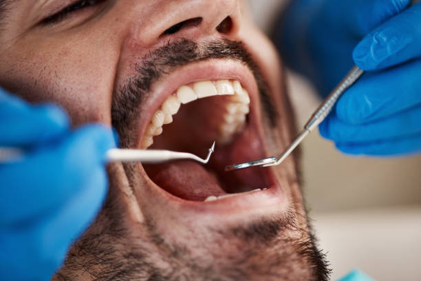 Best Chipped Tooth Repair Near Me  in Topaz Ranch Estates, NV