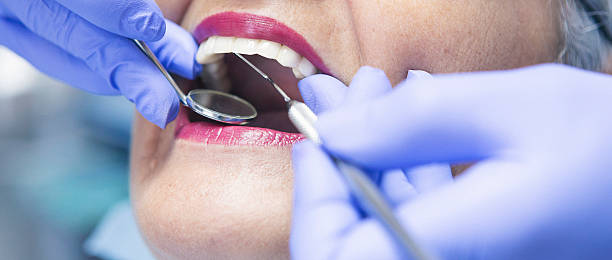 Best Knocked-Out Tooth Emergency  in Topaz Ranch Estates, NV